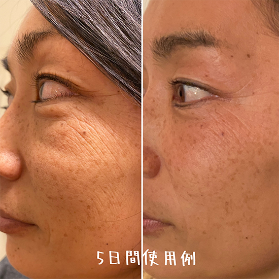 【定期配送・送料無料】3回以上の購入条件◆Lahaina for Beach People コスメ&サプリ パーフェクトセット◆